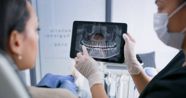 Licensed Dental Implants service in California, CA - Smile Center Dentistry